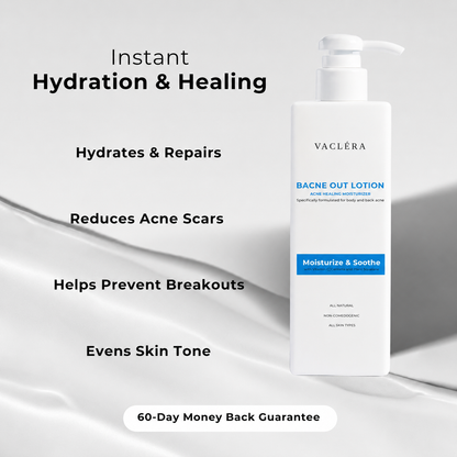 Bacne Out Lotion